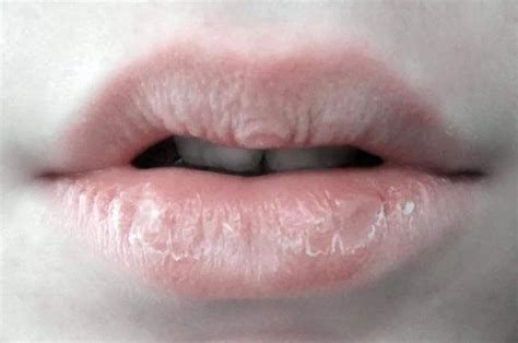 嘴唇乾裂、脫皮？是這幾種原因害的，早發現只是小事！ 每日頭條