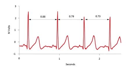 Heart Rate Variability Hrv Science For Sport