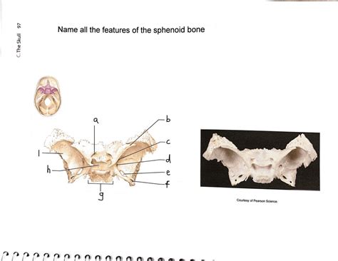 Sphenoid Bone Diagram Quizlet