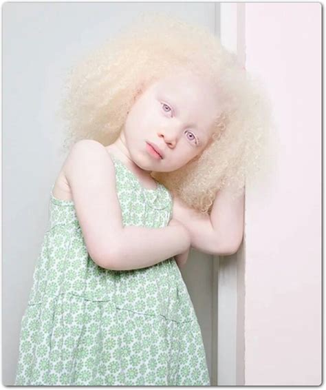 15 hermosas fotografías de Albinos que te dejarán sin palabras