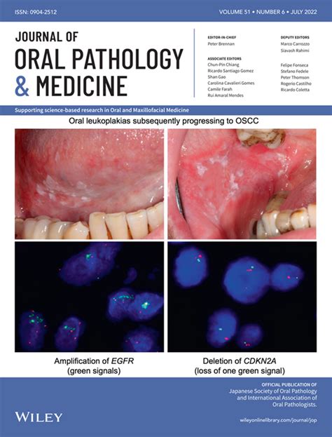 Journal Of Oral Pathology And Medicine Vol 51 No 6