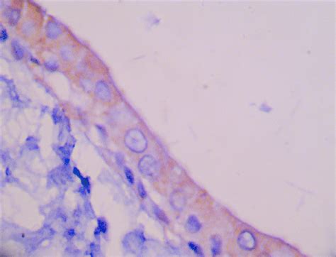 Photomicrograph Showing Dfree Stained With Ck 14 Ihc Stain X200 Download Scientific Diagram