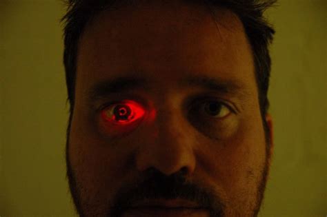 Filmmaker Eyeborg Replaced His Deteriorating Eye With A Video Camera