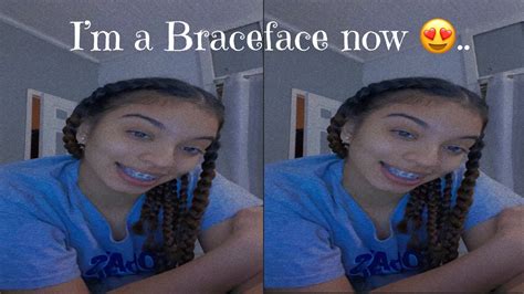I Got Braces 😁 Youtube