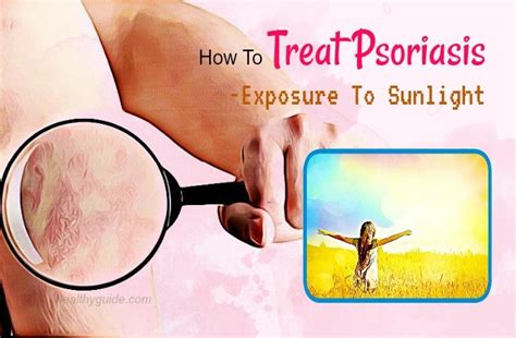 14 Tips How To Treat Psoriasis On Face Hand Scalp Earsand Eyelids Fast