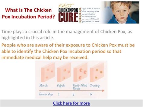 Chicken Pox Contagious Period Adults