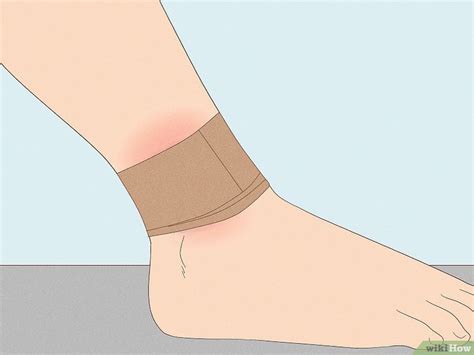 How To Heal A Bruise First Aid And Remedies For Fast Healing