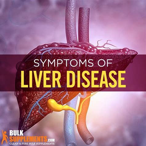 Liver Disease Symptoms Causes And Treatment By Science Connecting