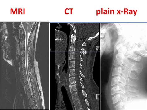 In this video you will learn about ct scan vs mri vs ultrasound how ct scan works. Difference between an MRI, CT and X-ray scan. - Omega PDS