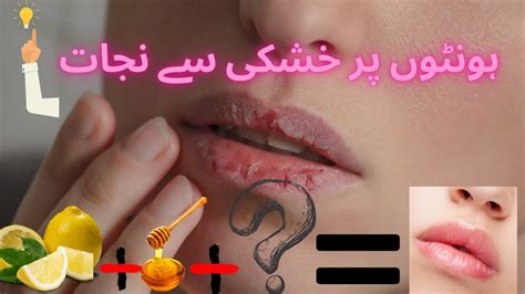 Remedy For Dry Lips In Winter Lips Care Cracked And Dry Lips Care