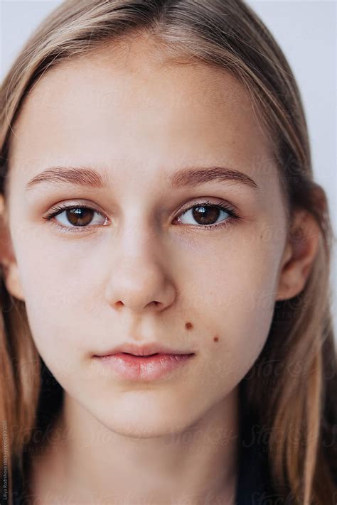 Pretty Teenager With Cute Moles By Liliya Rodnikova Face Moles