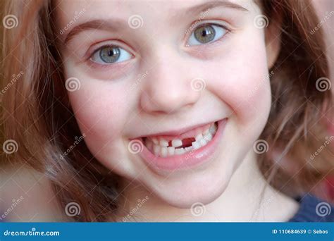 The Adorable Girl Smiles With The Fall Of The First Baby Teeth Stock