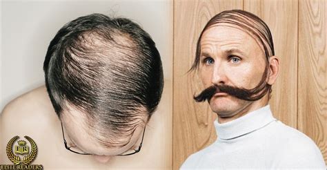 Choose one of our hairstyles for balding men, thinning hair, or mphl. Avoid This Hairstyle If You Don't Want to Go Bald - Elite ...