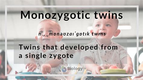 types of monozygotic twins