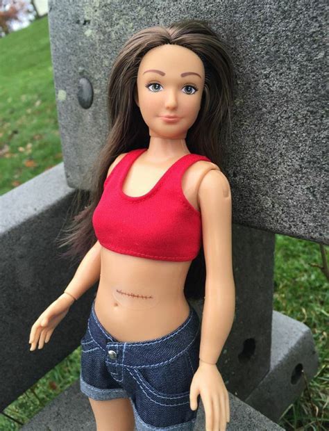 Normal Barbie Comes With Acne Stretch Marks And Cellulite Daily Star