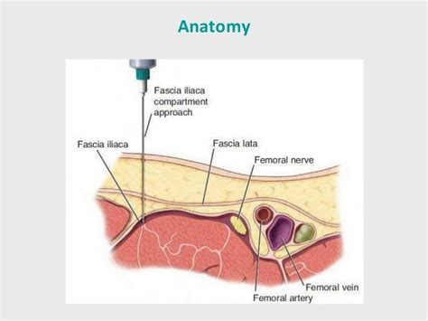 Fascia Iliaca Block