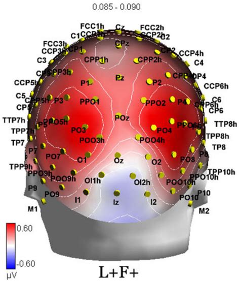 Posterior view of electrode scalp sites (topographic ma ...
