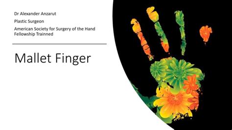 Mallet Finger Diagnosis And Treatment Dr Anzarut Plastic Surgery