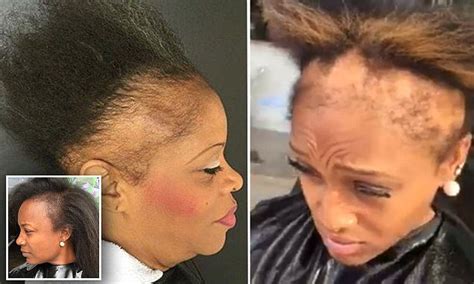 Atlanta Hairstylist Shares Videos Of Clients Suffering From Hair Loss Due To Weaves Daily Mail