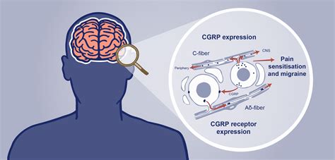 Spotlight On Cgrp Sites Of Action In Migraine Progress In Mind