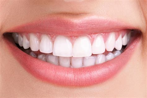 Best Smile Makeover In Chennai Implantree