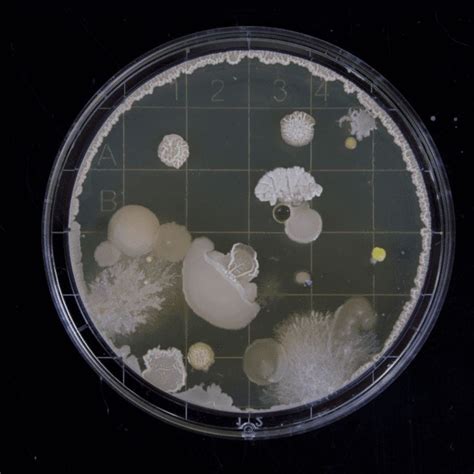 What Do Germs Look Like Science Activity For Kids Germs For Kids