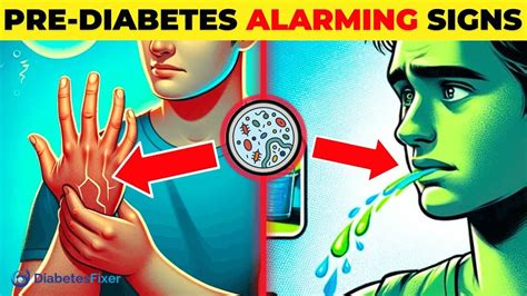 10 Prediabetes Signs You Must Know Youtube