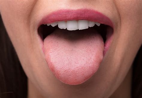 舌のトレーニング日吉の歯医者矢島歯科医院口呼吸から鼻呼吸へ