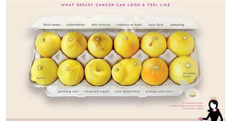 What Breast Cancer Looks Like Album On Imgur