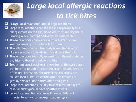 Ppt Allergic Reactions Due To Tick Bites Powerpoint Presentation