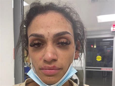 Nba Wife Shows Gruesome Photos Of Her Face After Being Physically Abused