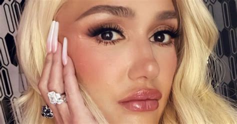 Gwen Stefani Fans Beg Her To Stop Lip Fillers Botox As She Shows Off Very Plump Pout