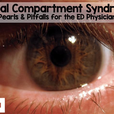 Orbital Compartment Syndrome Pearls And Pitfalls For The Ed Physician