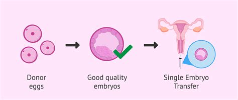 Single Embryo Transfer For The Gestational Carrier