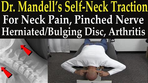 Dr Mandells Self Neck Traction Technique For Neck Pain Pinched Nerve