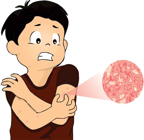 Treatment For Kidney Disease How To Relieve Itching Skin In Chronic