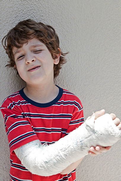 Boy Broken Arm Stock Photos Pictures And Royalty Free Images Istock