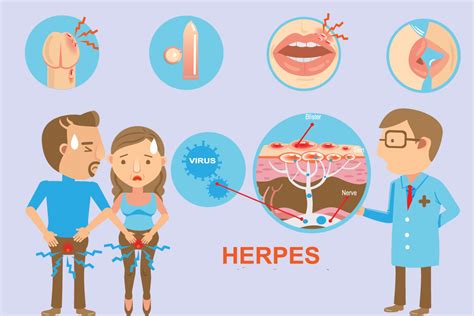 all you need to know about genital herpes