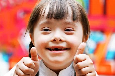 Down syndrome is a lifelong condition. Was ist das Down-Syndrom? - Erklär's mir - Badische Zeitung