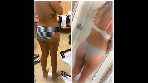 6 Week Post Op Bbl And Lipo Youtube