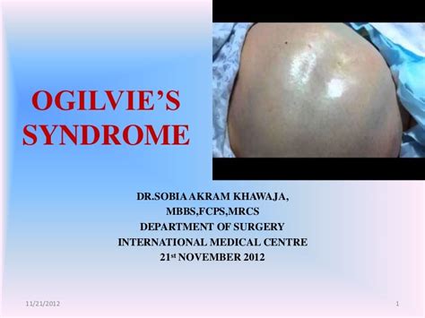 Ogilvies Syndrome