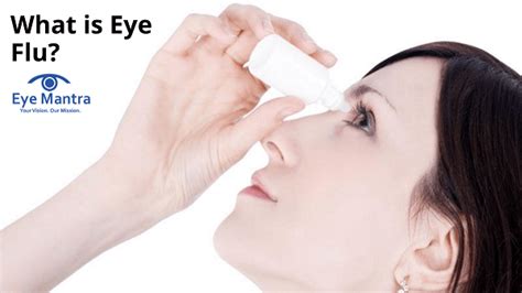 What Is Eye Flu Eye Flu Best Eye Treatment Eyemantra