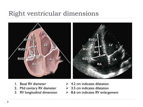 Ppt Echocardiographic Assessment Of The Right Heart In Adults
