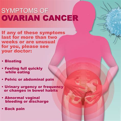 Olson sh, mignone l, nakaraseive c,, caputo ta, barakat rr, harlap s. Natural Ovarian Cyst Cure