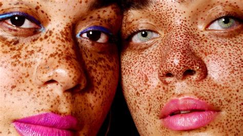 What Causes Freckles Heres How They Form Insider