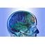 Cortical Lobes  Stock Image C007/9640 Science Photo Library
