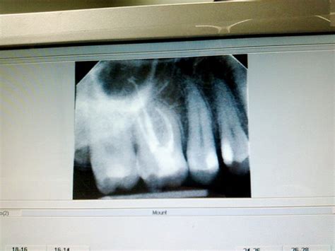 For patients without health insurance, we offer affordable self, pay rates. How Much Does a Panoramic Dental X Rays Cost? | HowMuchIsIt.org