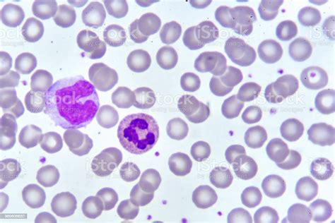 単球および好中球の細胞 血友病のストックフォトや画像を多数ご用意 血友病 分析する 細胞 Istock