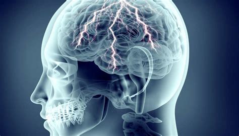 A seizure is the physical findings or changes in behavior that occur after an episode of abnormal. Complex partial seizures: Symptoms and types