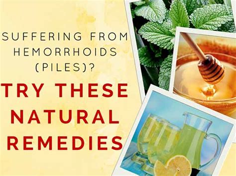 5 Effective Natural Remedies To Cure Haemorrhoids Piles